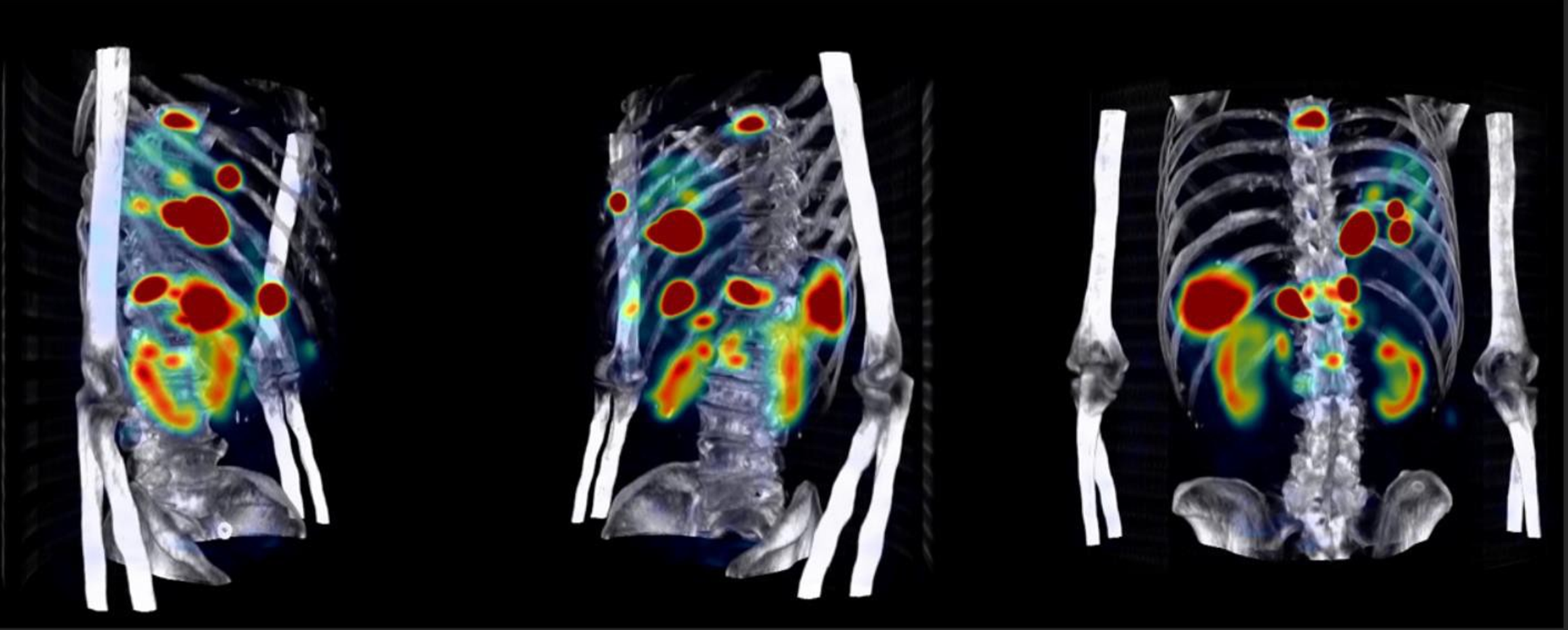 核医学治療線量計算ソフトウェア