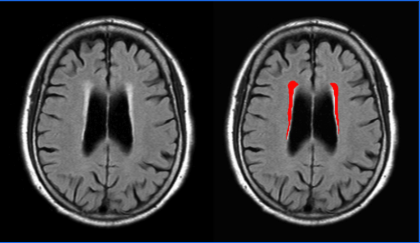 汎用画像診断装置ワークステーション用プログラム