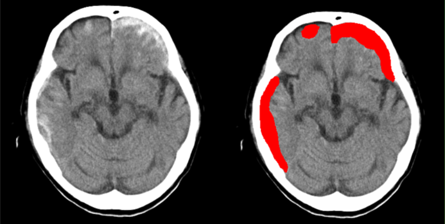 汎用画像診断装置ワークステーション用プログラム