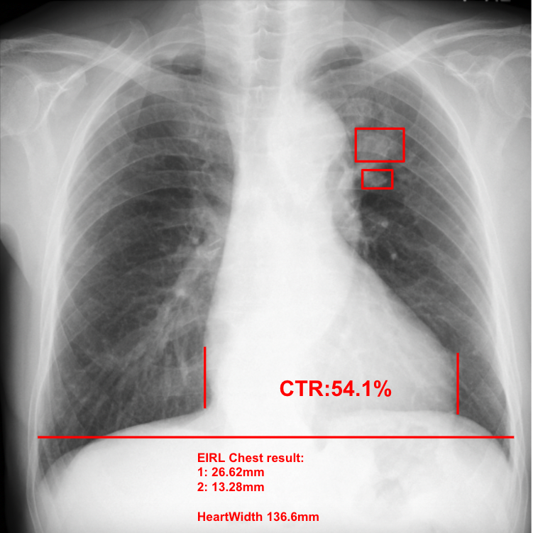 X線画像診断装置ワークステーション用プログラム