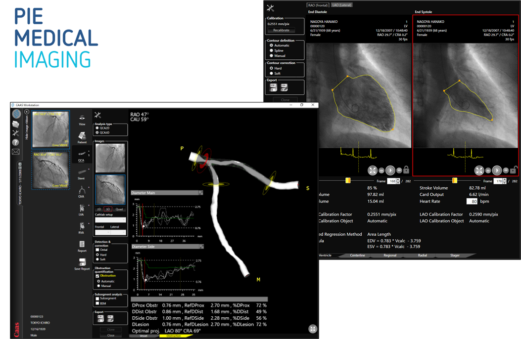 Ｘ線画像診断装置ワークステーション用プログラム