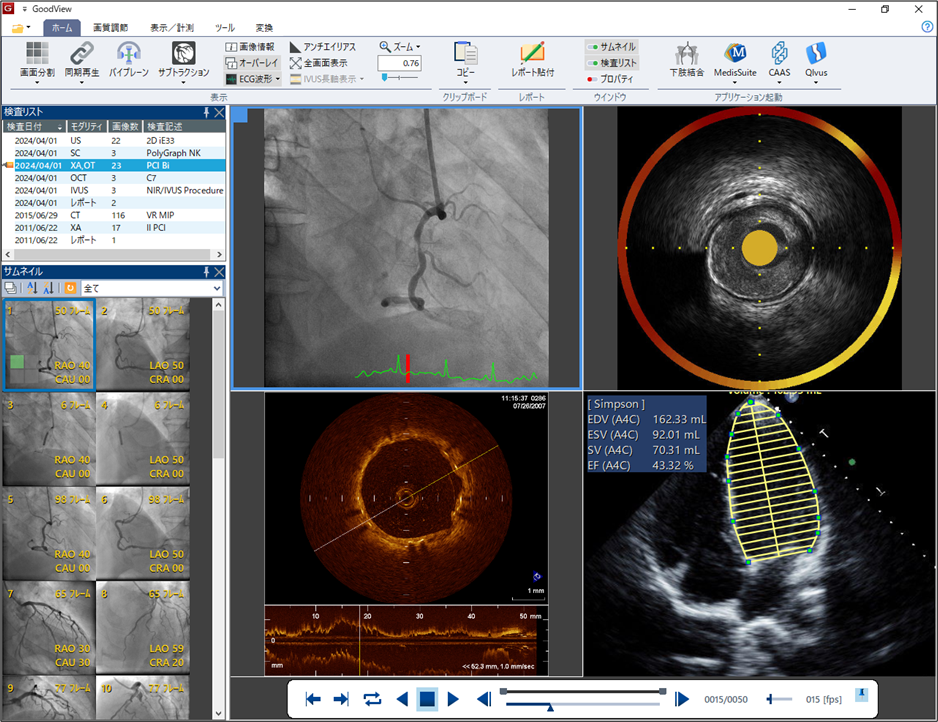 汎用画像診断装置ワークステーション用プログラム