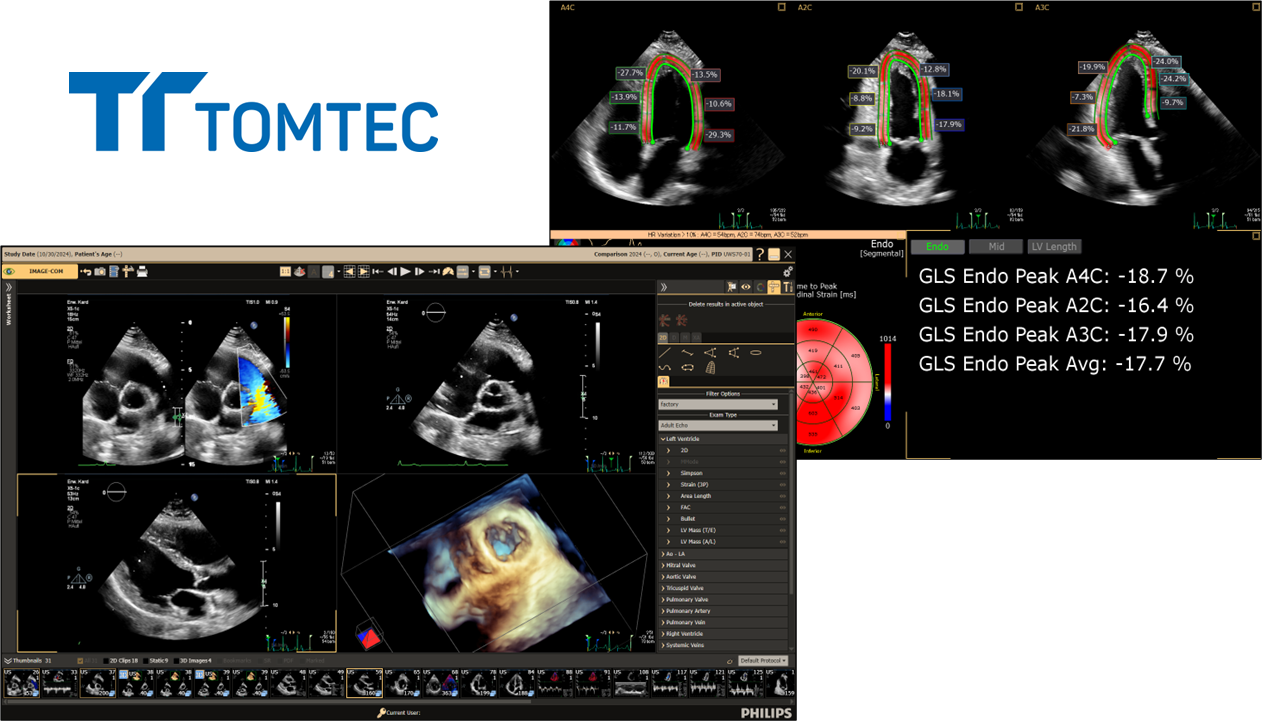 汎用画像診断装置ワークステーション用プログラム