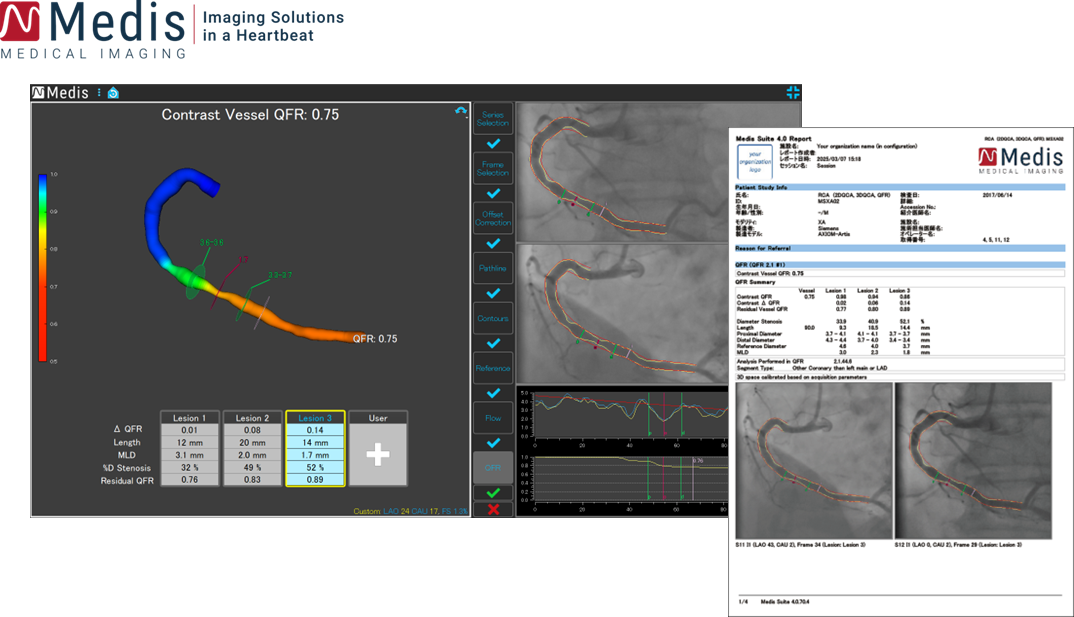 循環動態解析プログラム
