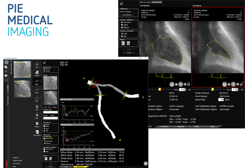 Ｘ線画像診断装置ワークステーション用プログラム