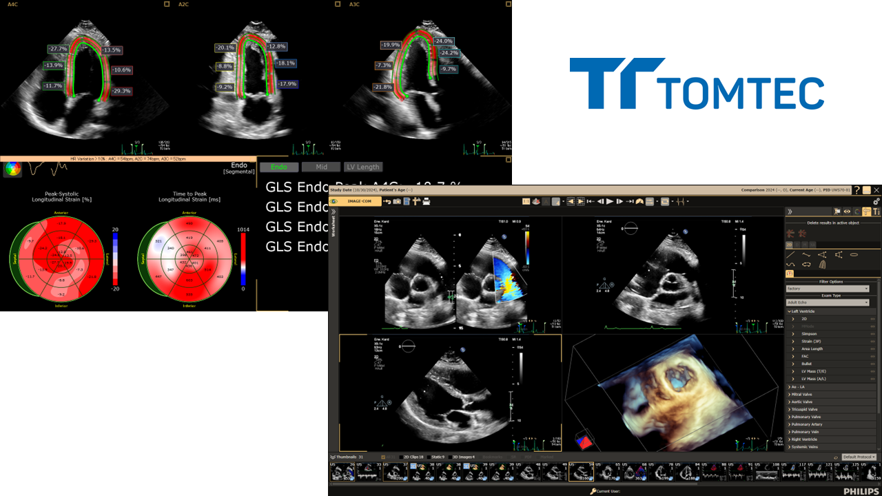 汎用画像診断装置ワークステーション用プログラム