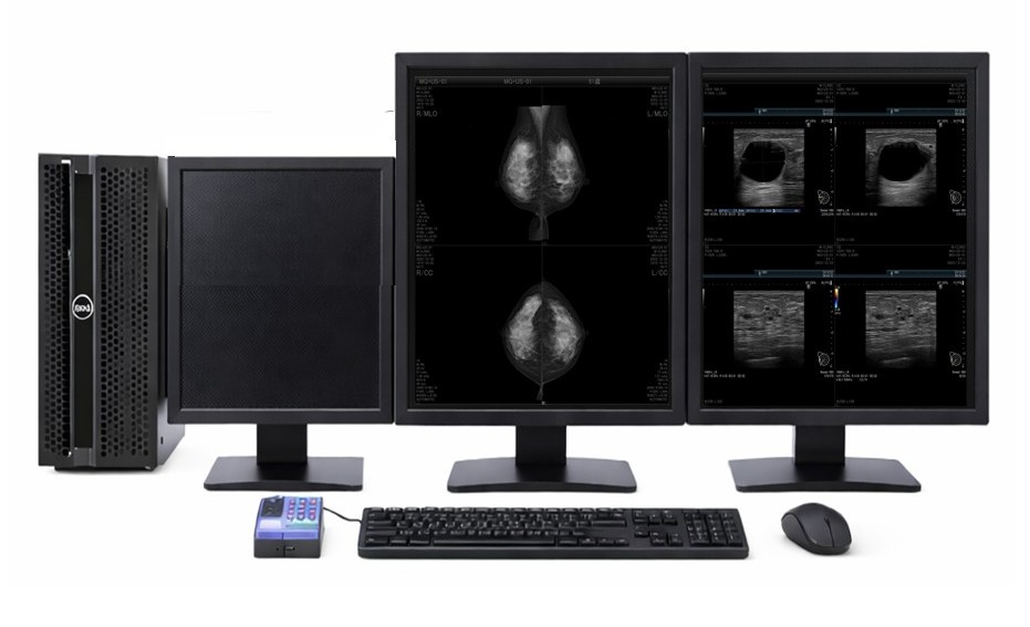 汎用画像診断ワークステーション