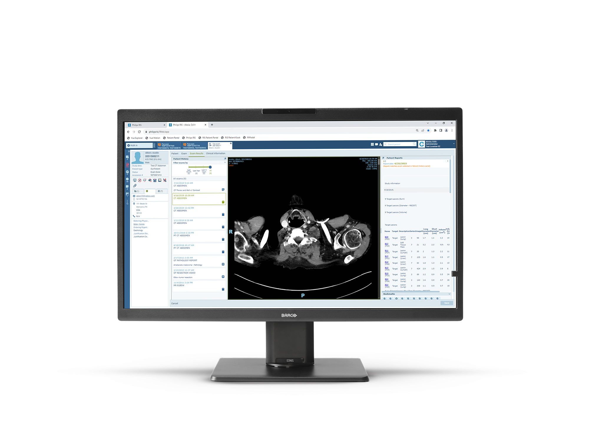 PACSディスプレイ /8MP