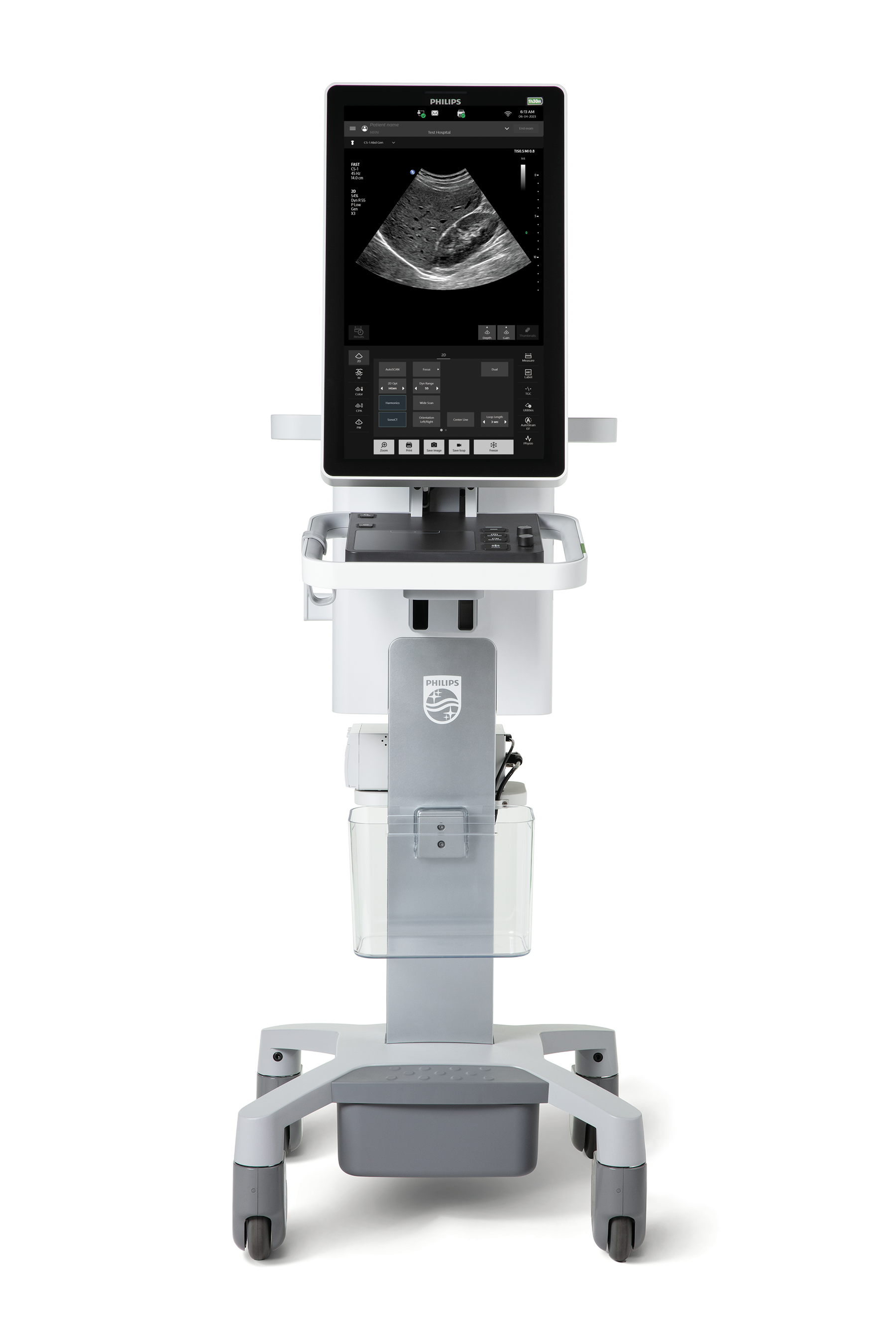 超音波診断装置