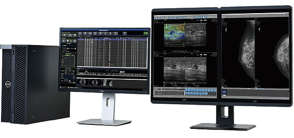マンモグラフィ画像診断システム