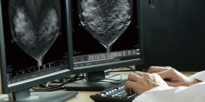 マンモグラフィビューア