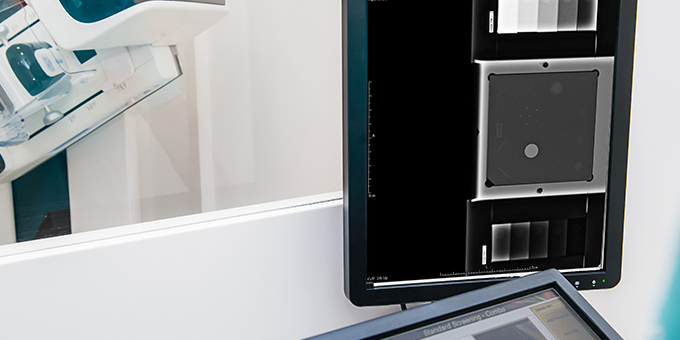 マンモグラフィ日常管理ソフトウェア