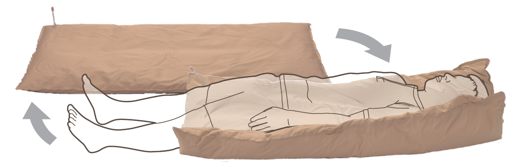 陰圧式患者固定具