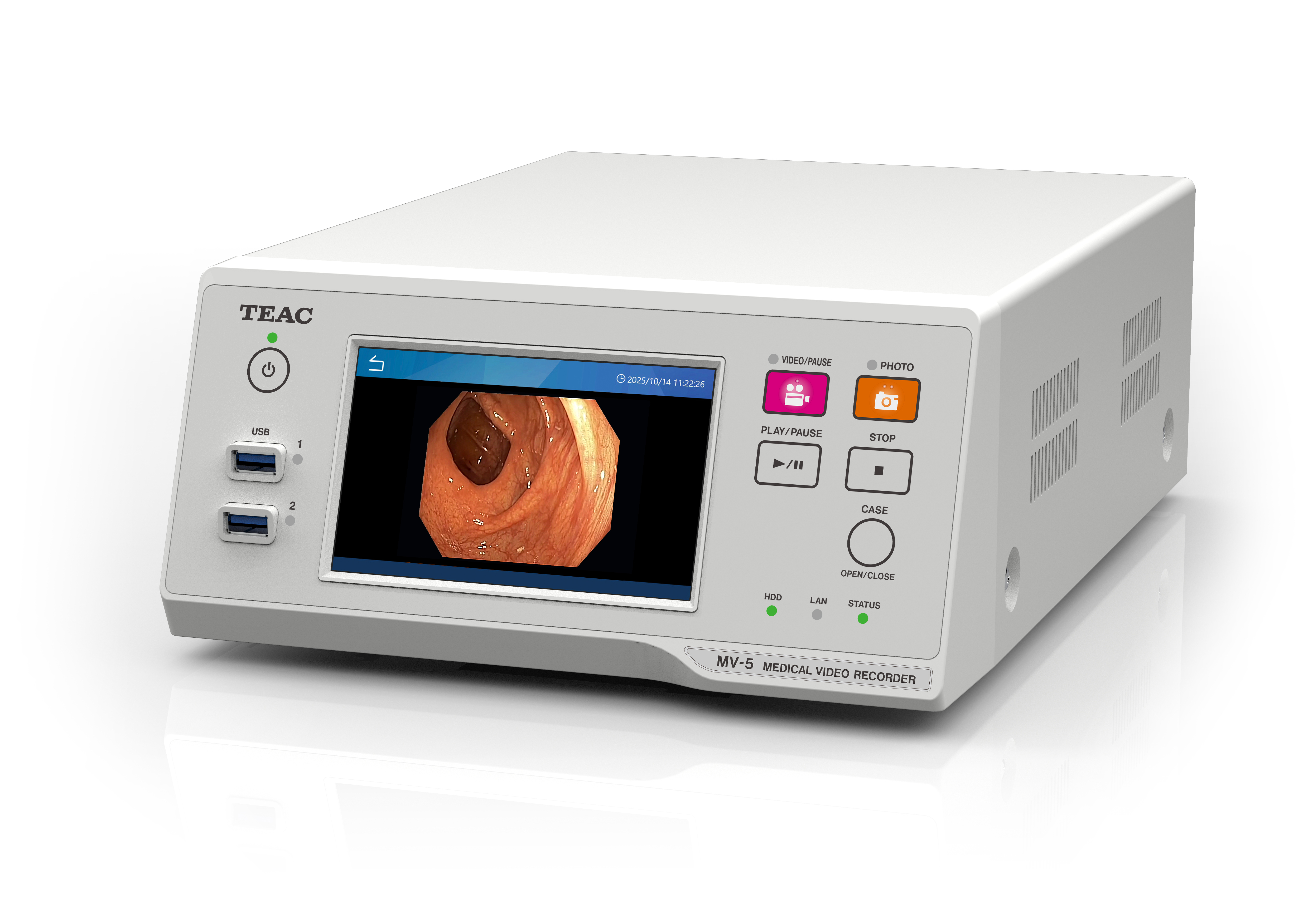 メディカルビデオレコーダー