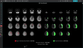 MR装置装置ワークステーション用プログラム