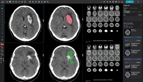 汎用画像診断装置ワークステーション用プログラム