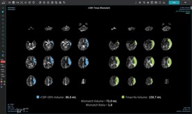 X線画像診断装置ワークステーション用プログラム