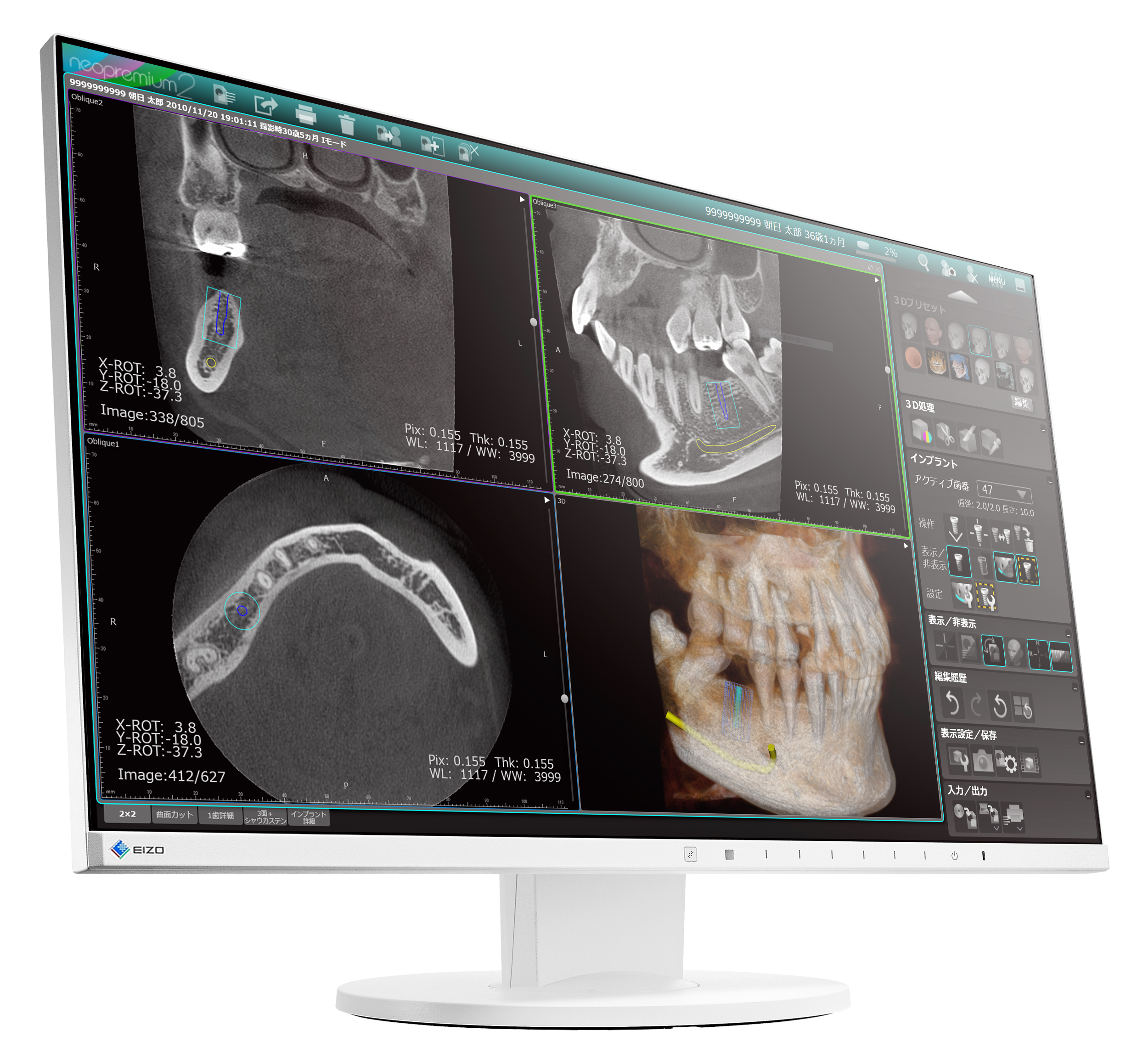 汎用画像診断装置ワークステーション用プログラム