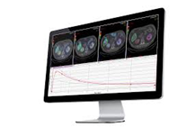 内用療法線量計算ソフトウェア