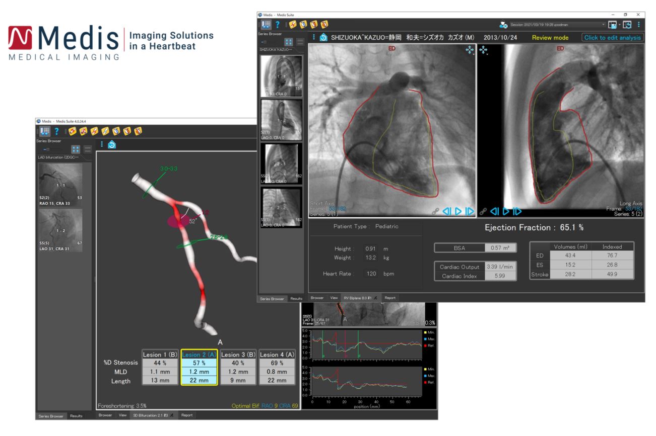 汎用画像診断装置ワークステーション用プログラム