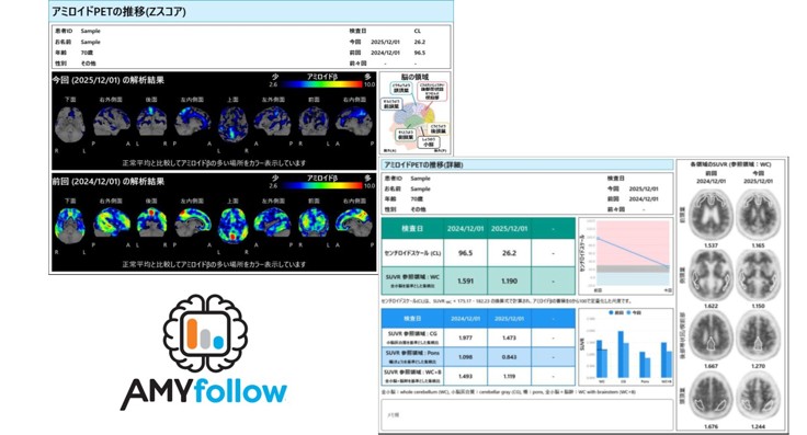 アミロイドPET経時変化レポート作成支援ソフトウェア
