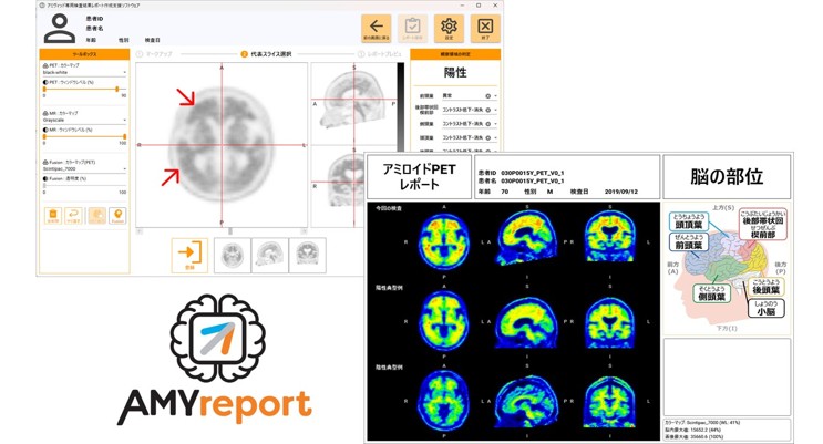 アミロイドPETレポート作成支援ソフトウェア