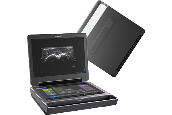 超音波画像診断装置