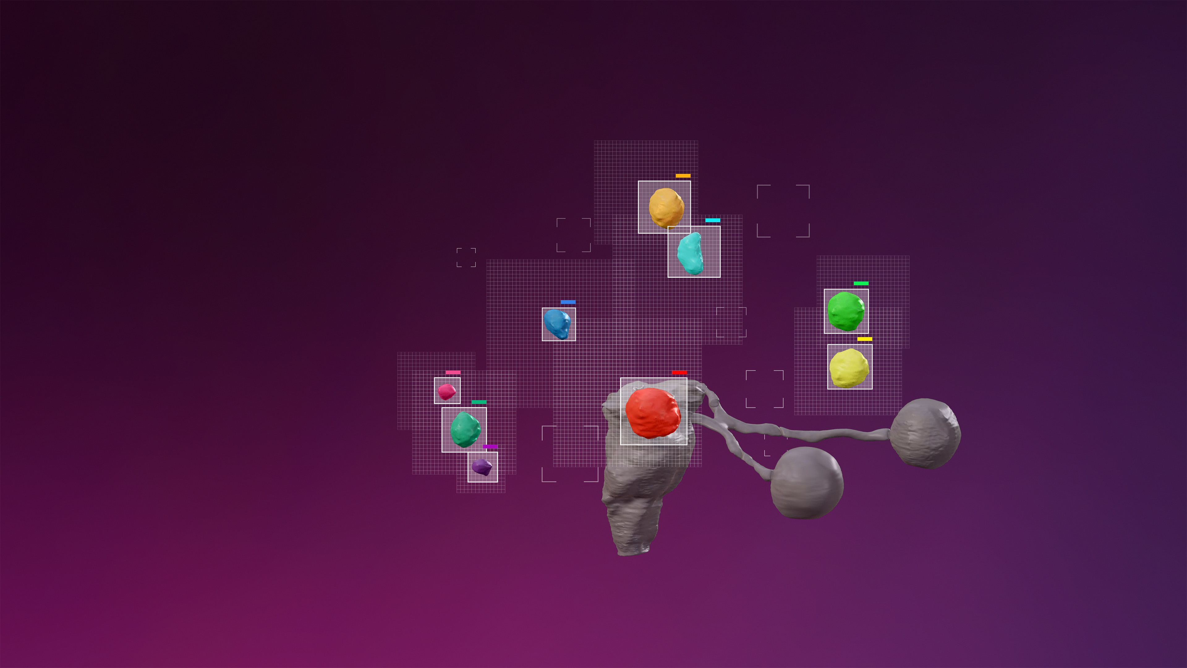 放射線治療計画プログラム